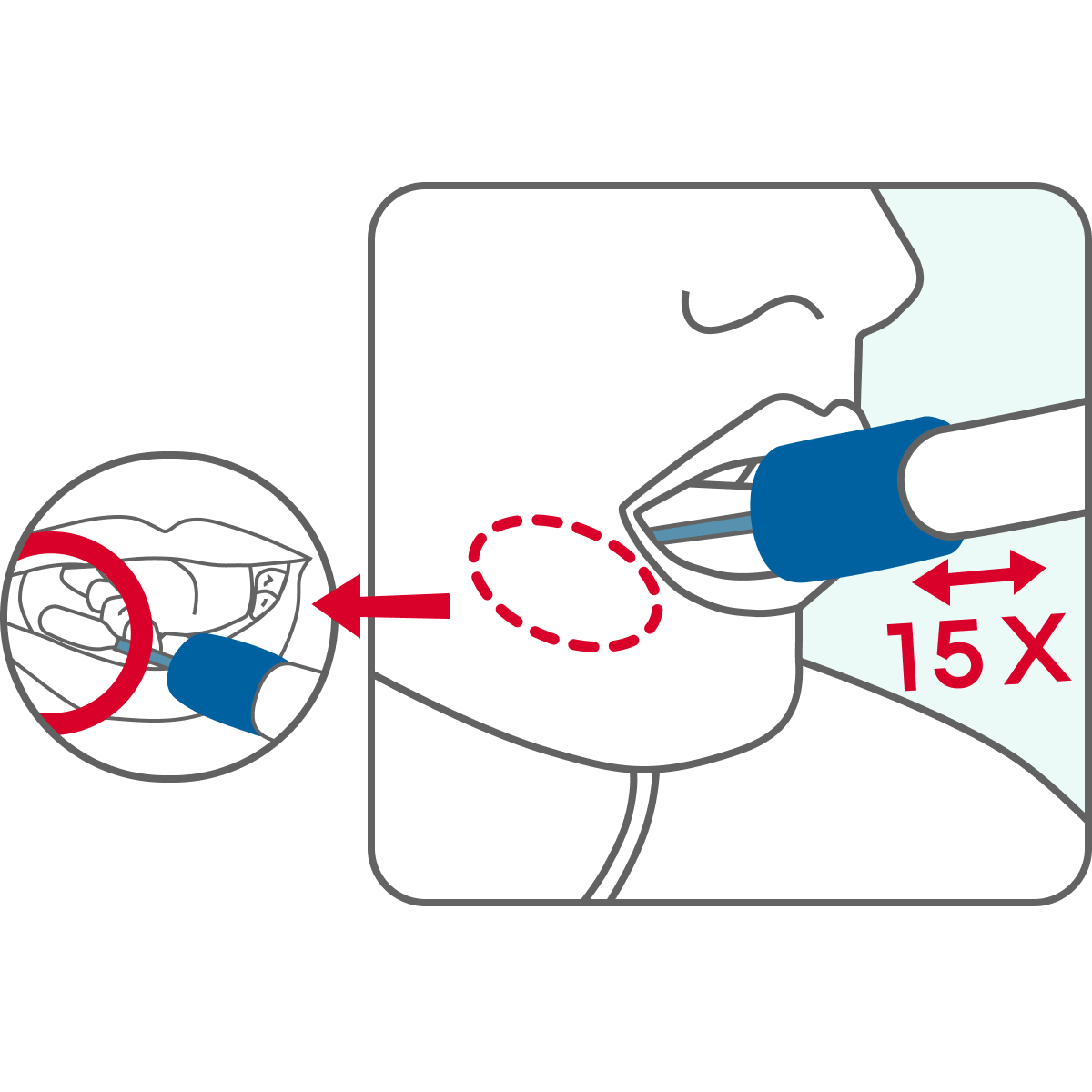 Geneus DNA ตรวจยังไง